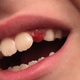 Illustration for article titled PEDIATRIC DENTISTS IN BANGALORE